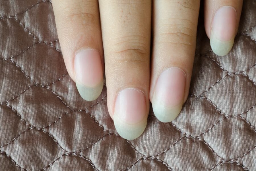 Nagelwachstum beschleunigen